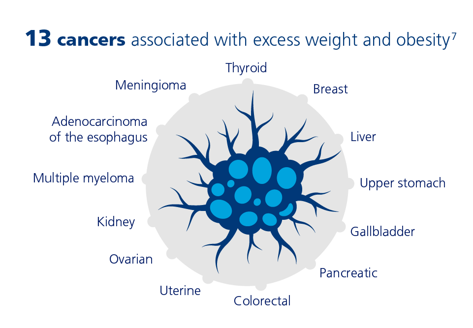13 cancers associated with excess weight and obesity