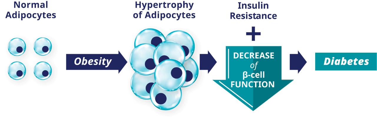 Potential mechanism linking obesity to diabetes graphic